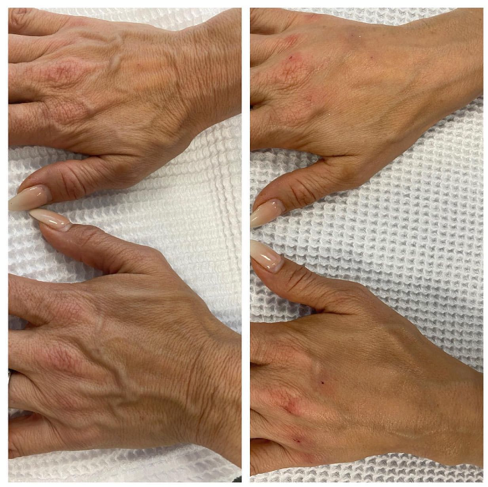 Blush Med Spa - Enfield, CT