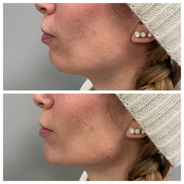 Blush Med Spa - Enfield, CT