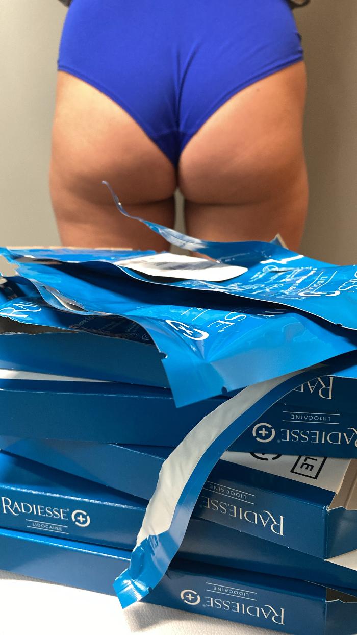 Blush Med Spa - Enfield, CT