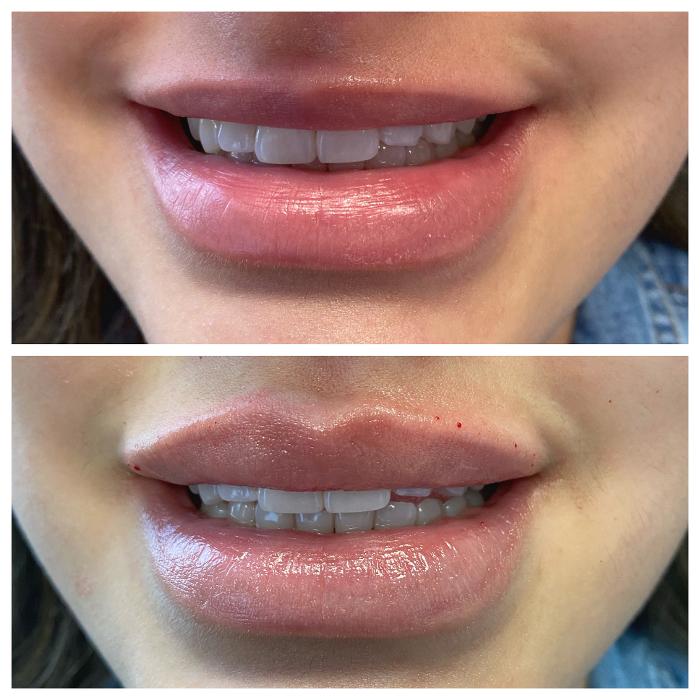 Blush Med Spa - Enfield, CT