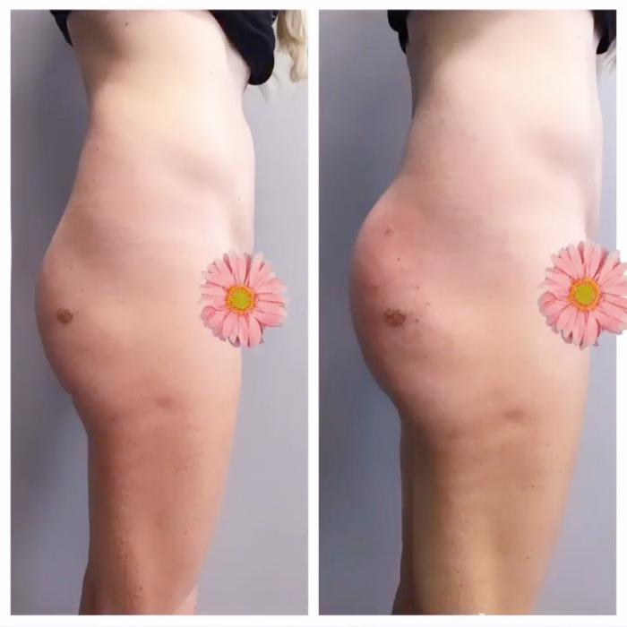 Blush Med Spa - Enfield, CT