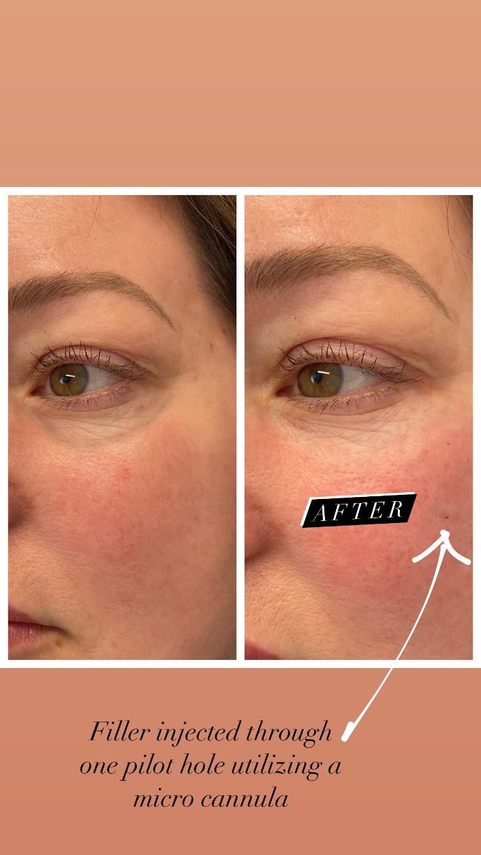 Blush Med Spa - Enfield, CT