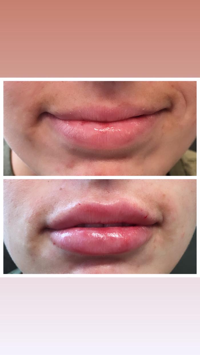 Blush Med Spa - Enfield, CT