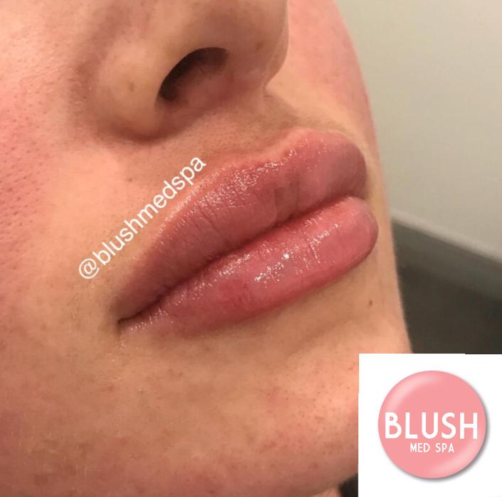 Blush Med Spa - Enfield, CT
