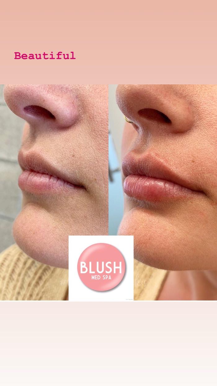 Blush Med Spa - Enfield, CT