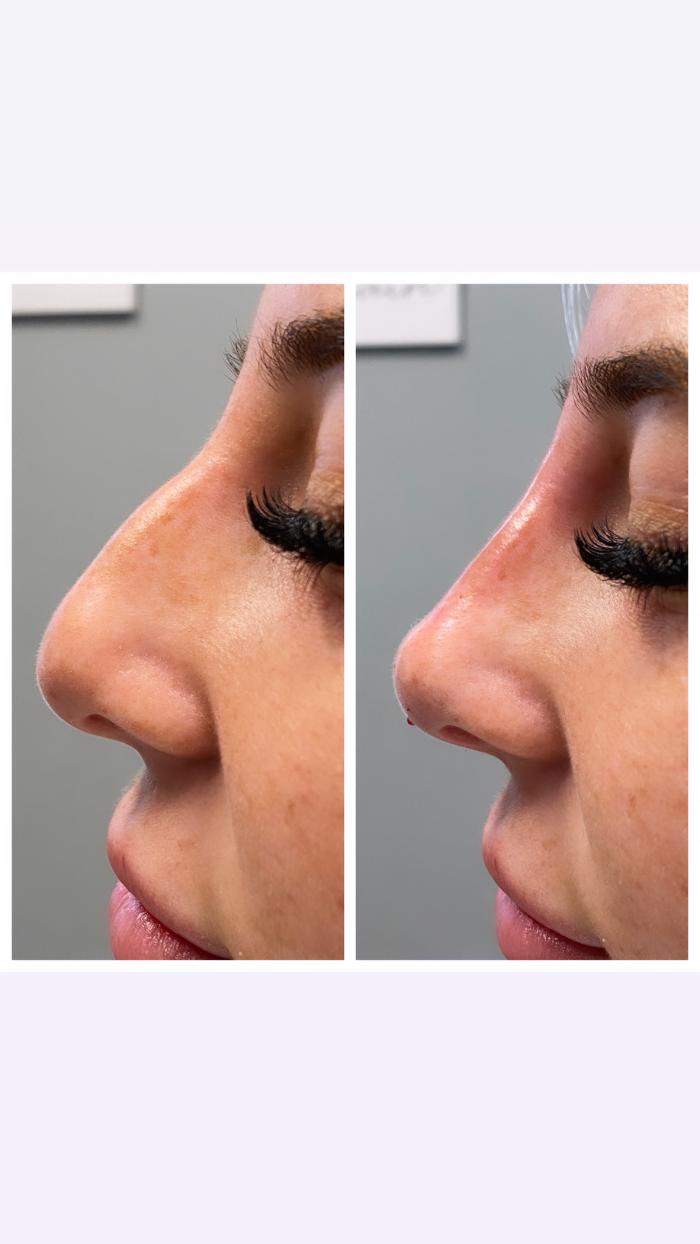 Blush Med Spa - Enfield, CT