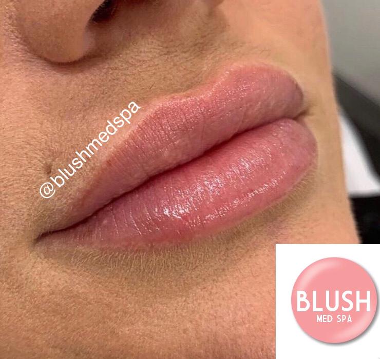 Blush Med Spa - Enfield, CT