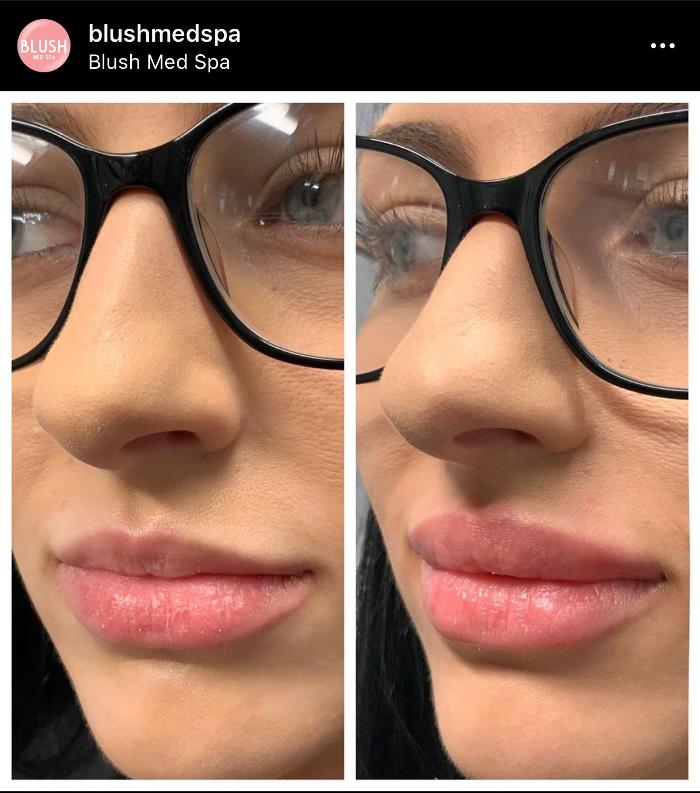 Blush Med Spa - Enfield, CT