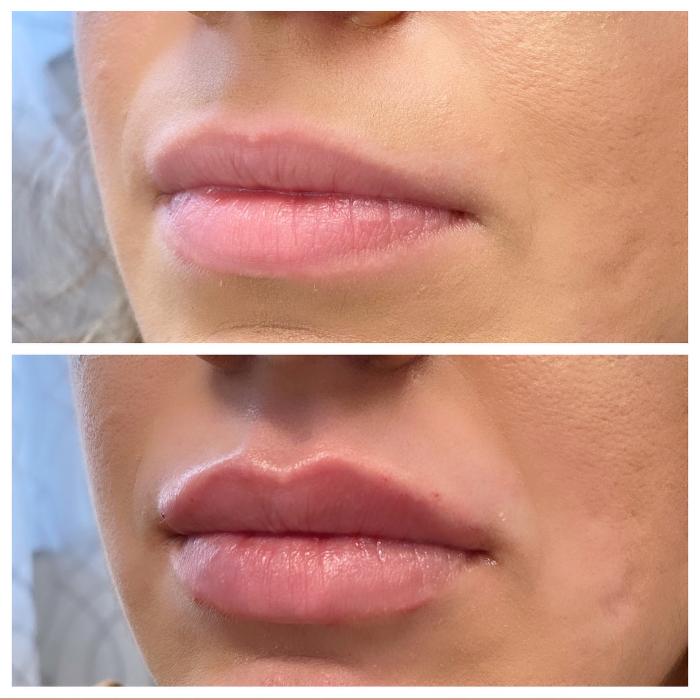 Blush Med Spa - Enfield, CT