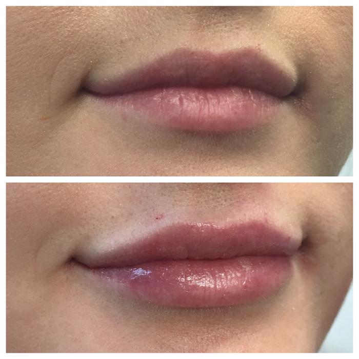 Blush Med Spa - Enfield, CT