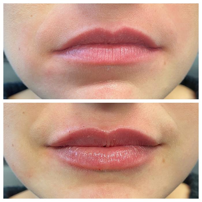 Blush Med Spa - Enfield, CT