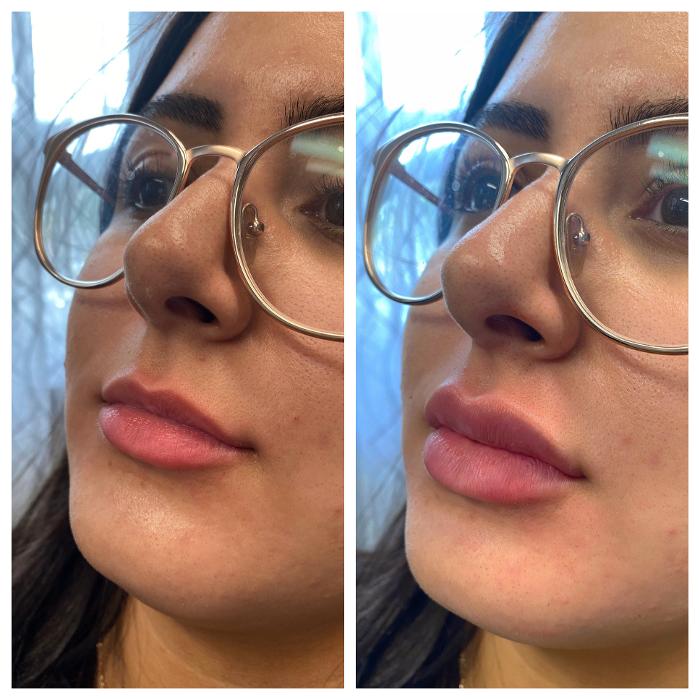 Blush Med Spa - Enfield, CT