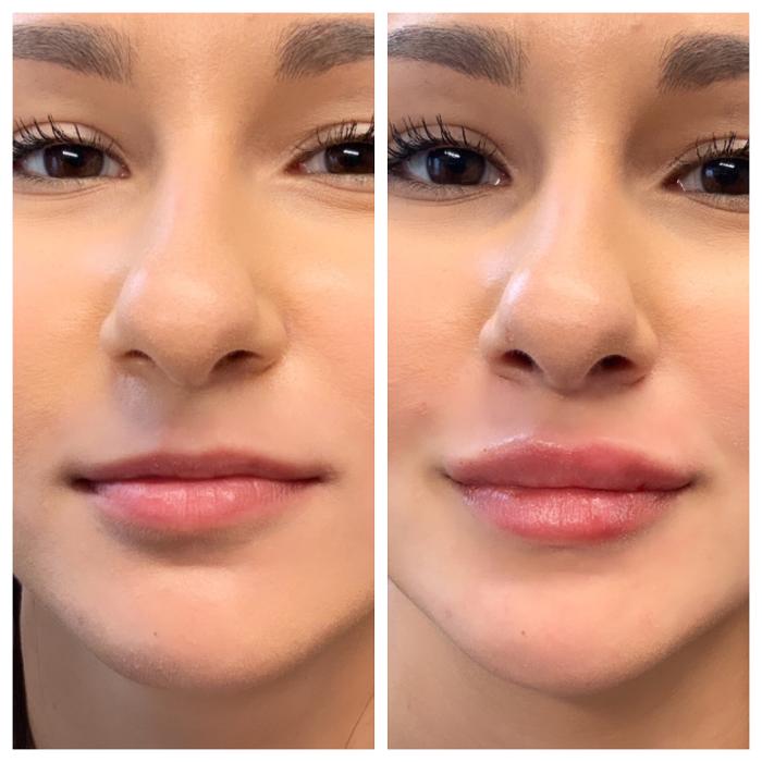 Blush Med Spa - Enfield, CT