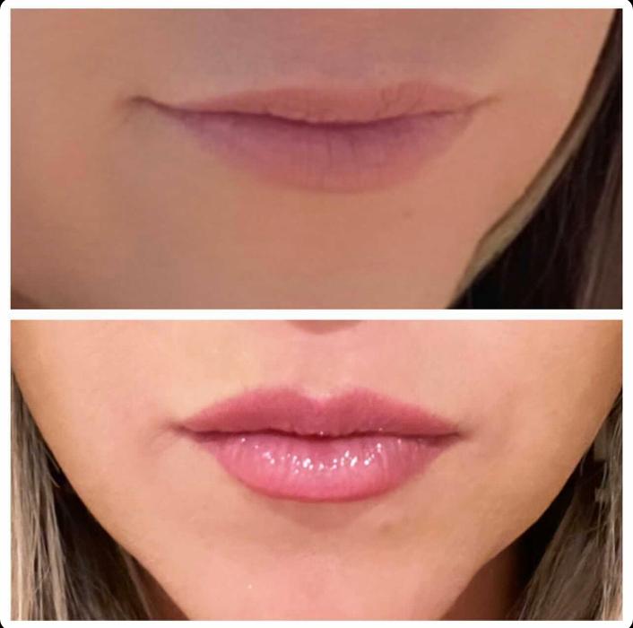 Blush Med Spa - Enfield, CT