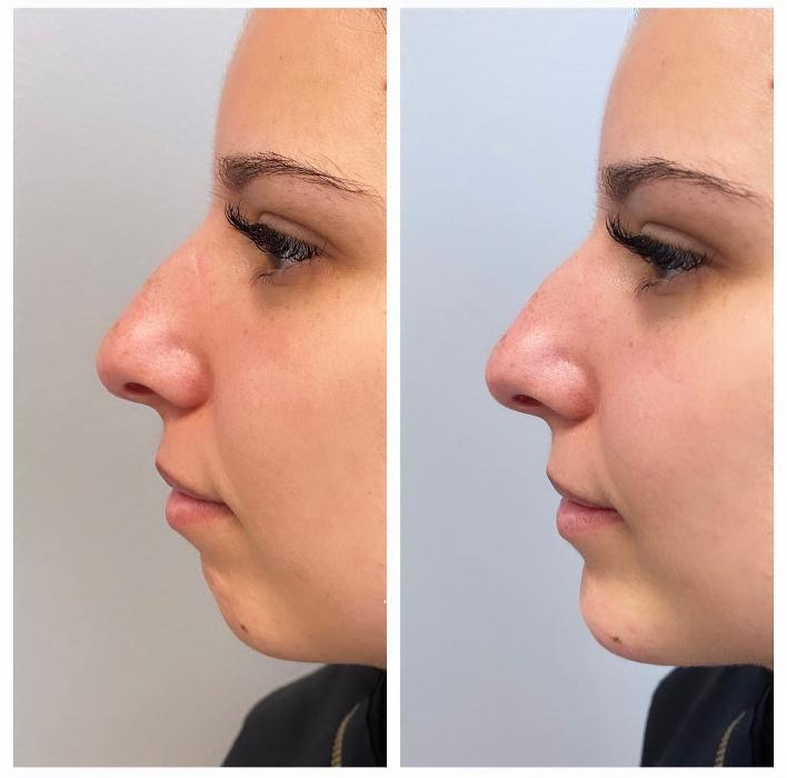 Blush Med Spa - Enfield, CT