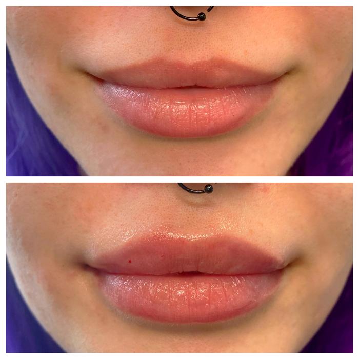 Blush Med Spa - Enfield, CT