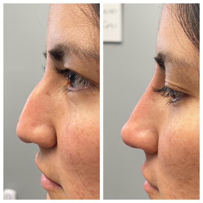 Blush Med Spa - Enfield, CT