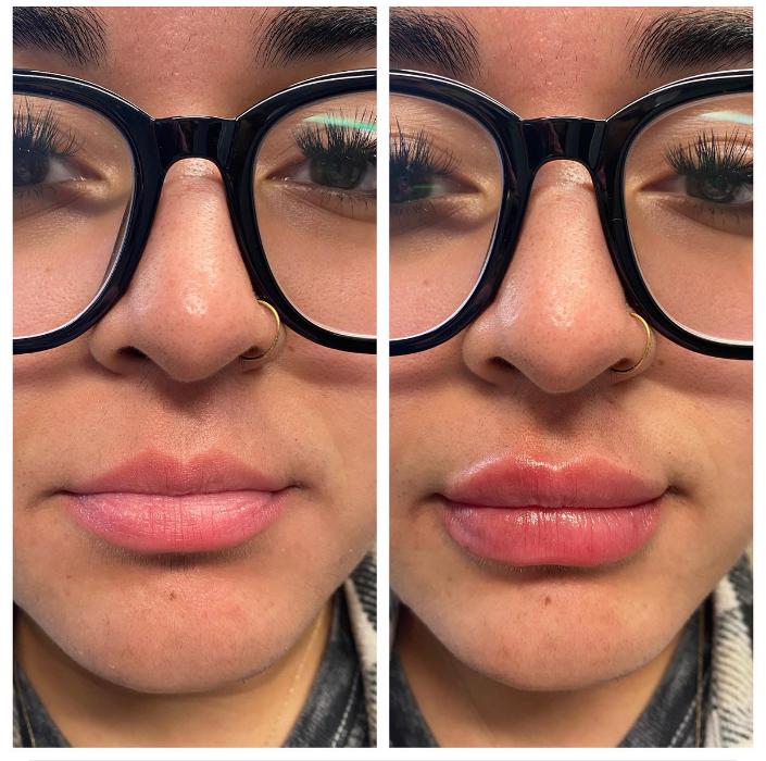 Blush Med Spa - Enfield, CT