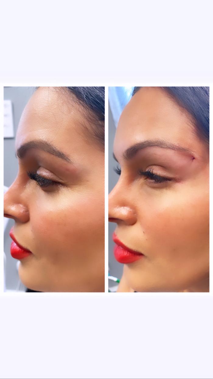 Blush Med Spa - Enfield, CT