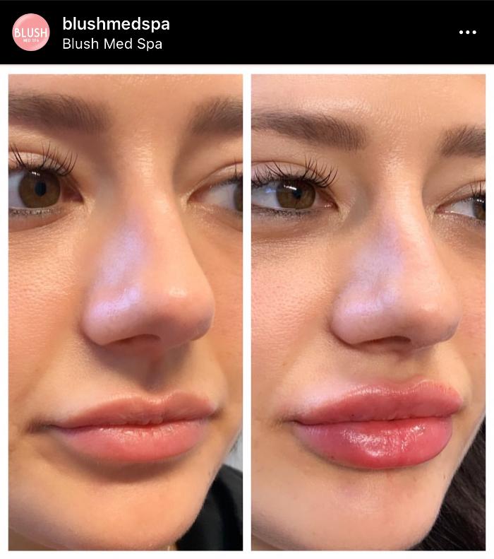 Blush Med Spa - Enfield, CT