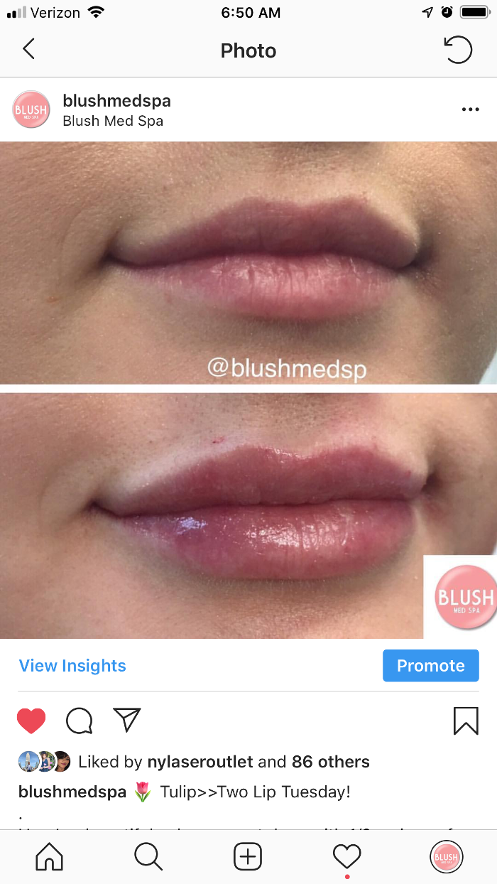 Blush Med Spa - Enfield, CT