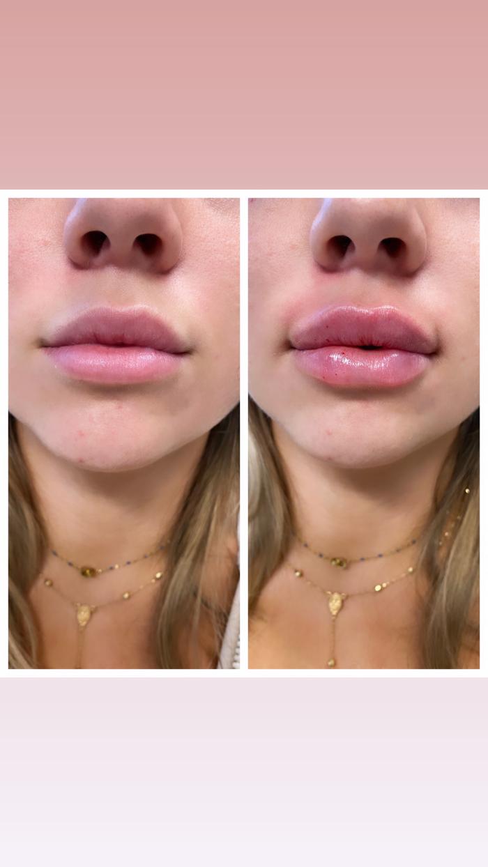 Blush Med Spa - Enfield, CT