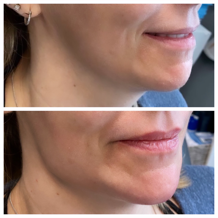 Blush Med Spa - Enfield, CT