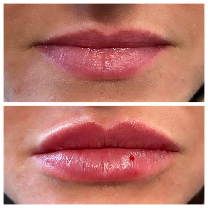 Blush Med Spa - Enfield, CT