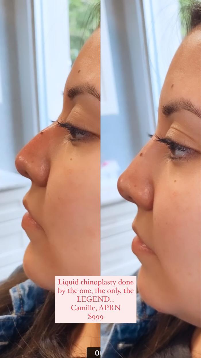 Blush Med Spa - Enfield, CT