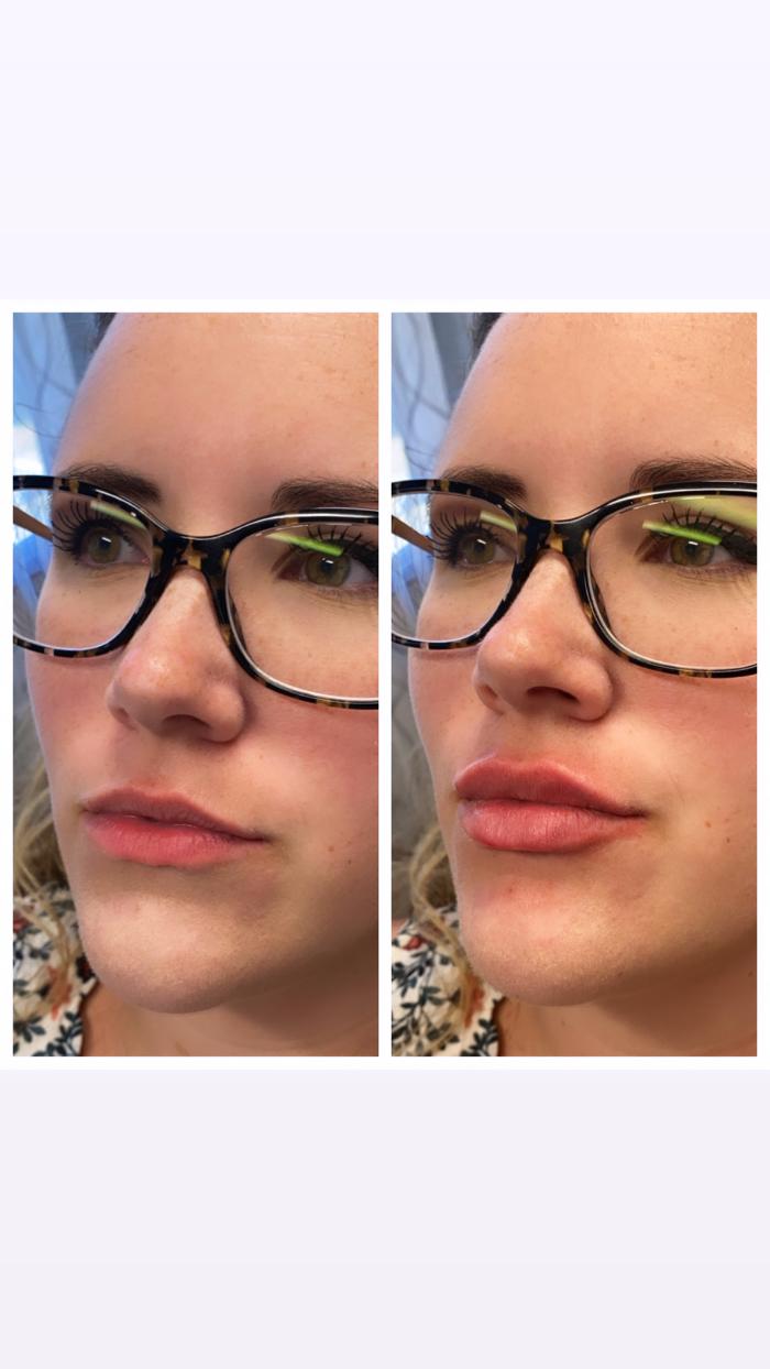 Blush Med Spa - Enfield, CT