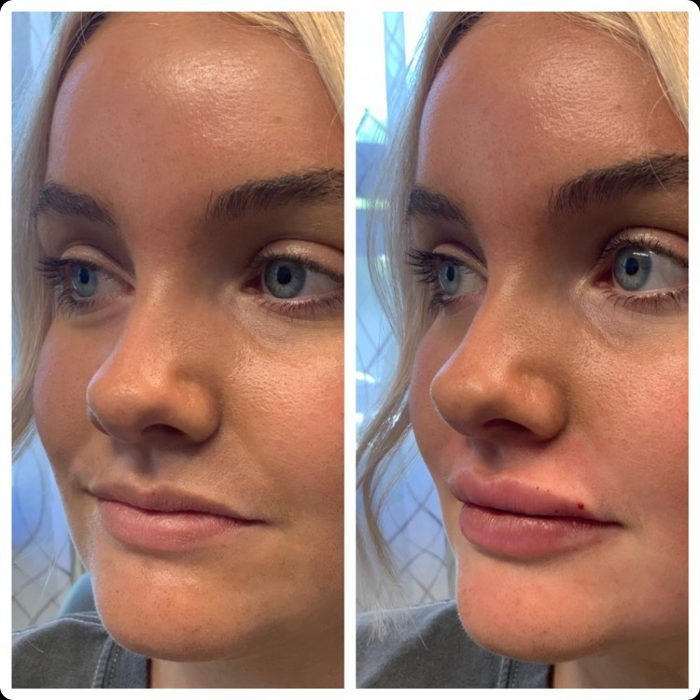 Blush Med Spa - Enfield, CT