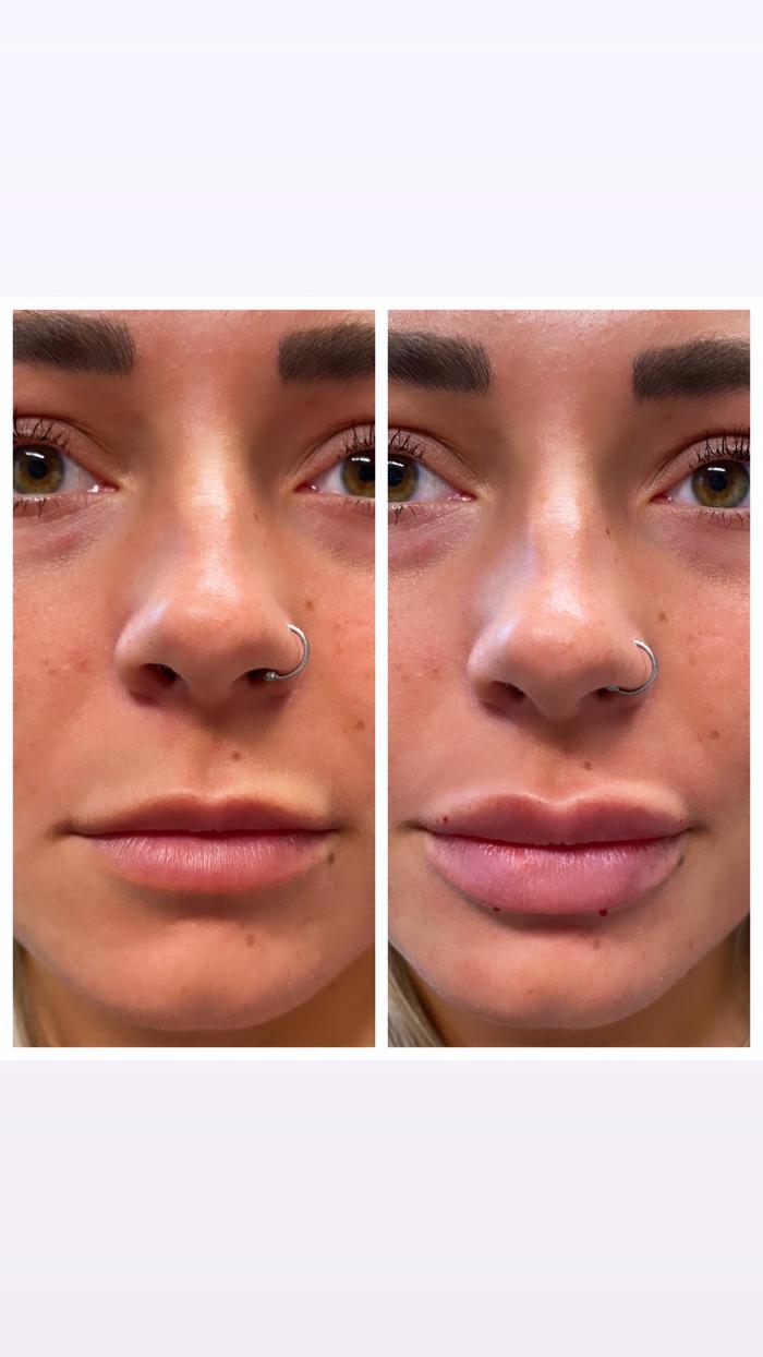 Blush Med Spa - Enfield, CT