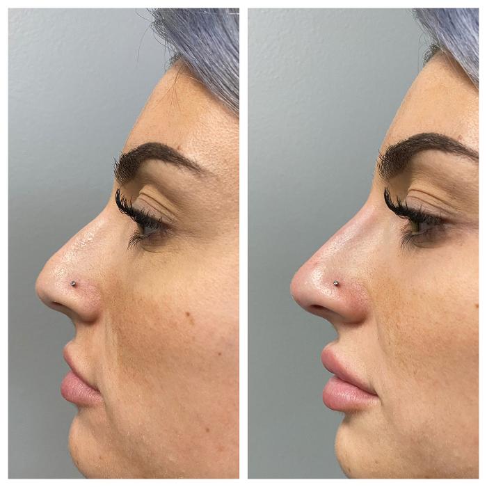 Blush Med Spa - Enfield, CT