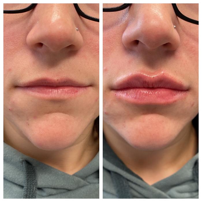 Blush Med Spa - Enfield, CT