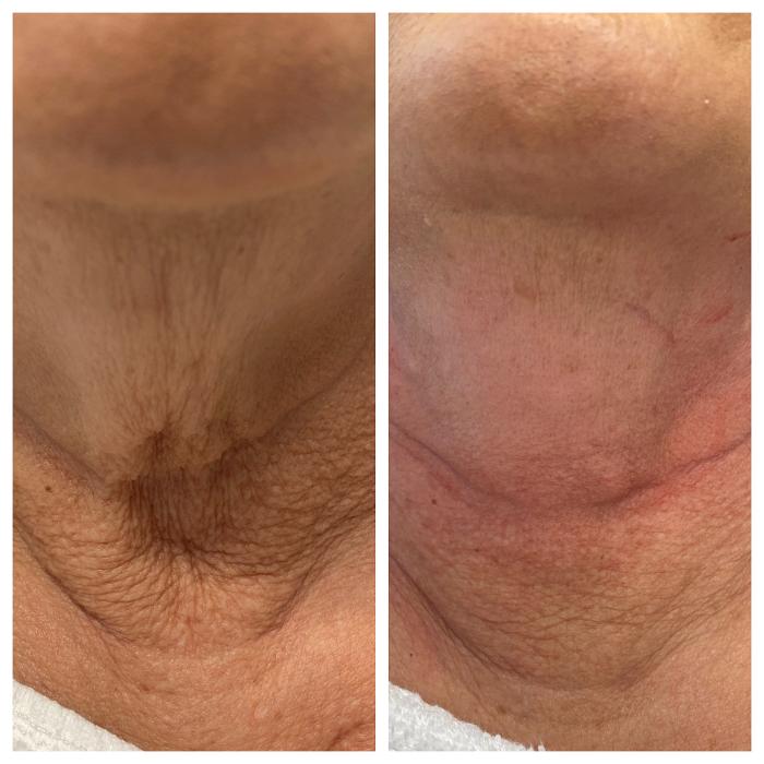 Blush Med Spa - Enfield, CT