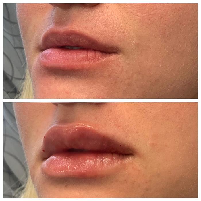 Blush Med Spa - Enfield, CT