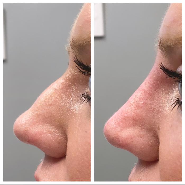 Blush Med Spa - Enfield, CT