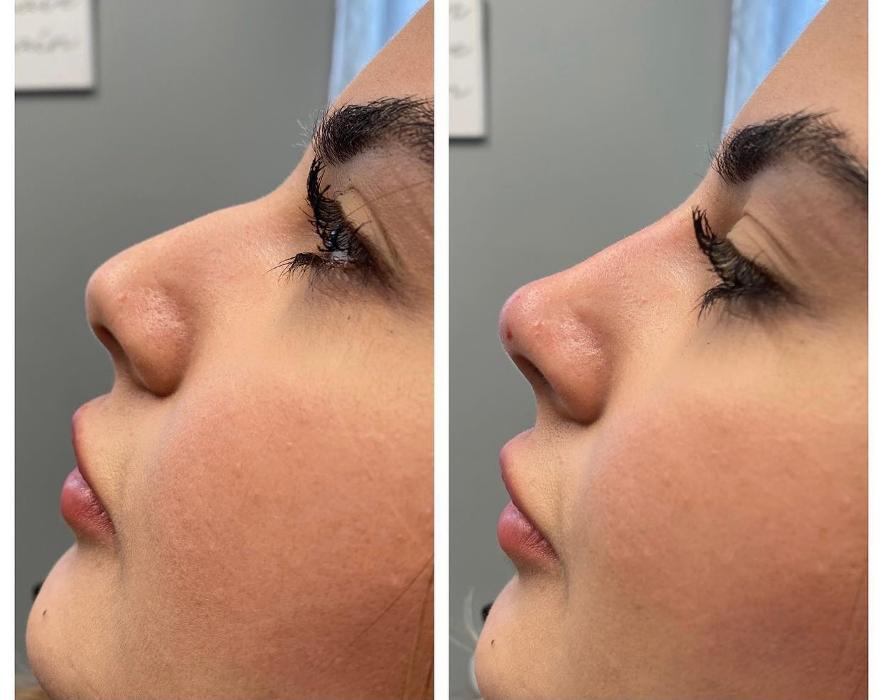 Blush Med Spa - Enfield, CT