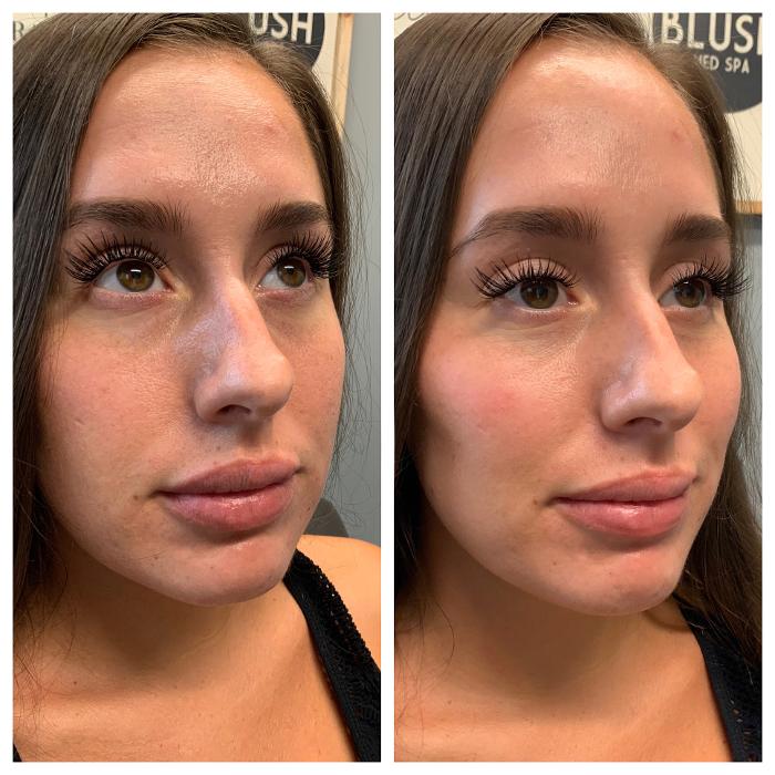 Blush Med Spa - Enfield, CT