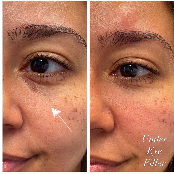 Blush Med Spa - Enfield, CT