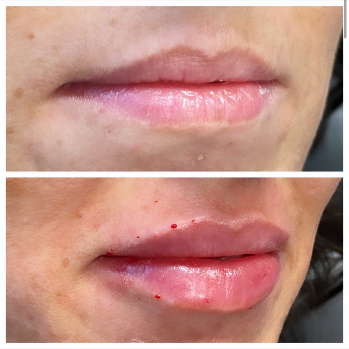 Blush Med Spa - Enfield, CT