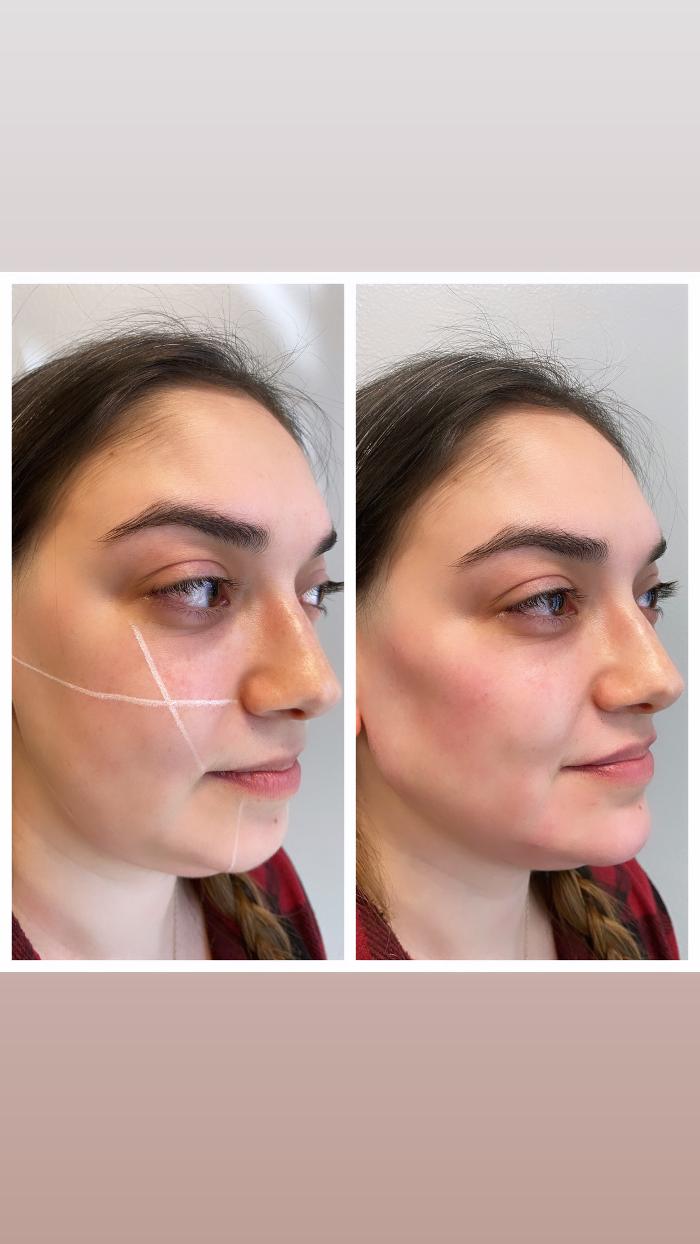 Blush Med Spa - Enfield, CT