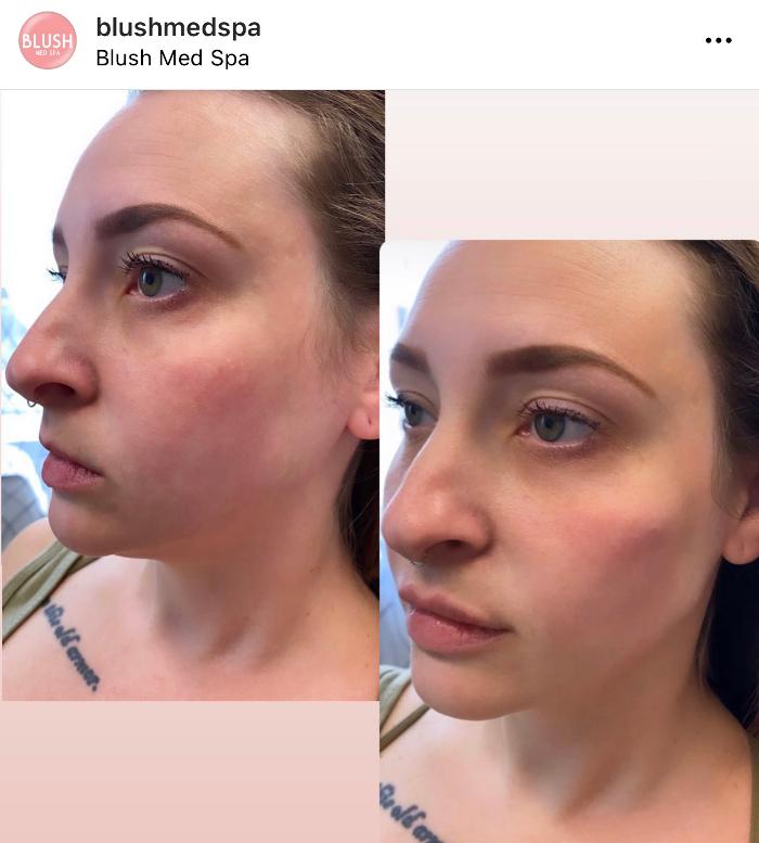 Blush Med Spa - Enfield, CT