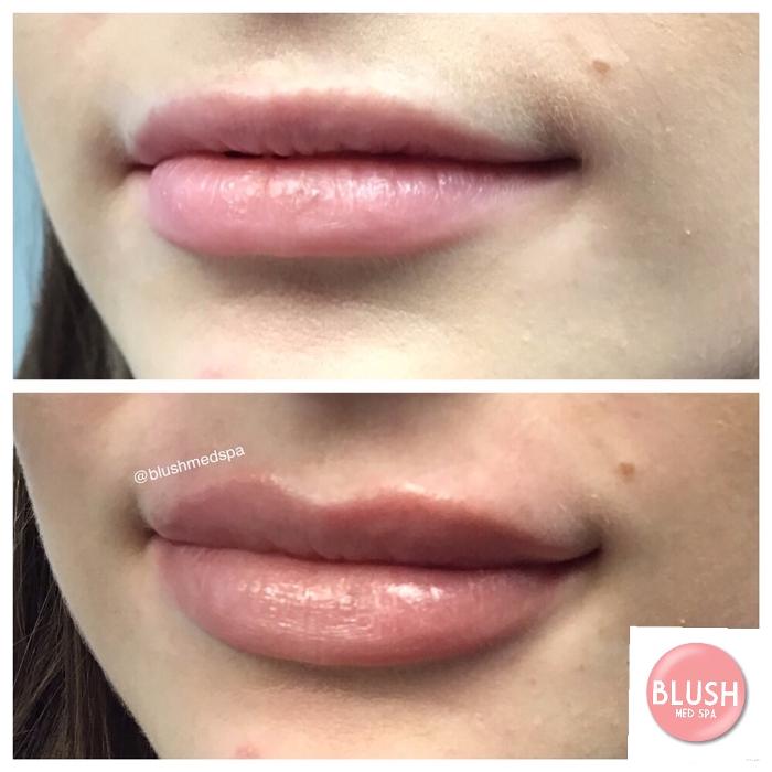 Blush Med Spa - Enfield, CT