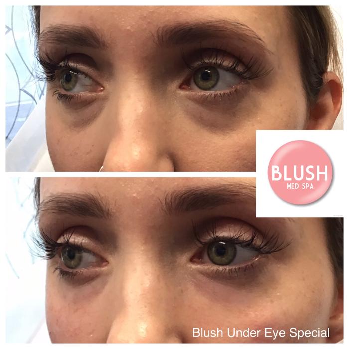 Blush Med Spa - Enfield, CT