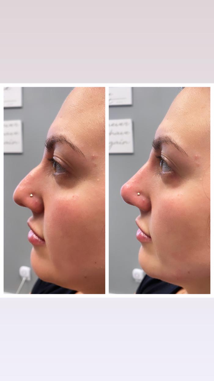 Blush Med Spa - Enfield, CT