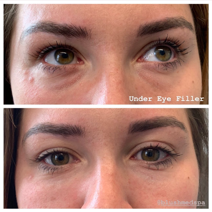 Blush Med Spa - Enfield, CT