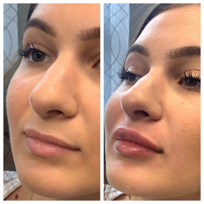 Blush Med Spa - Enfield, CT