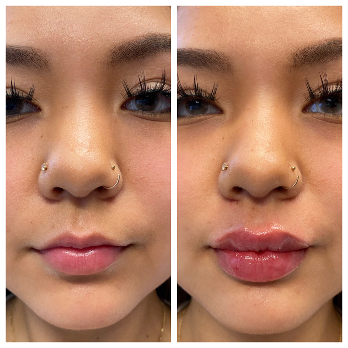 Blush Med Spa - Enfield, CT