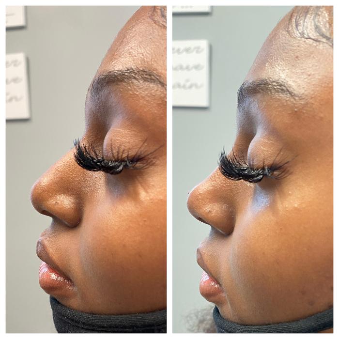 Blush Med Spa - Enfield, CT